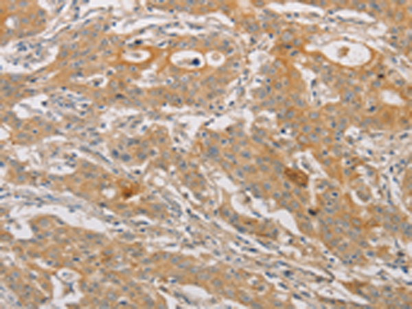 Rabbit Polyclonal Antibody to ARSK