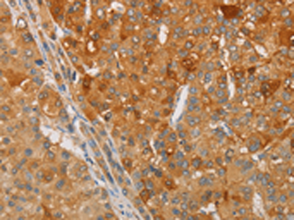 Rabbit Polyclonal Antibody to ARSG