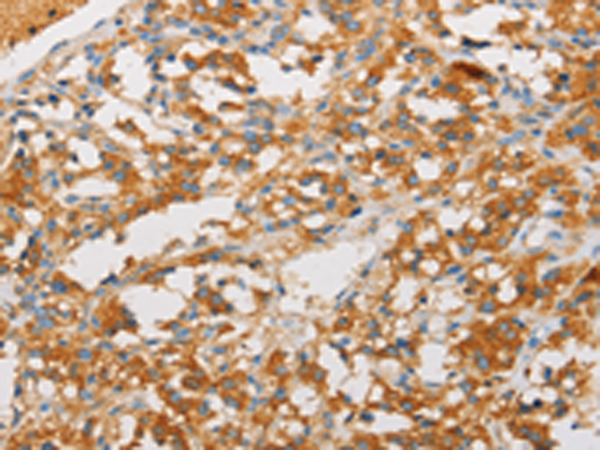 Rabbit Polyclonal Antibody to ART3