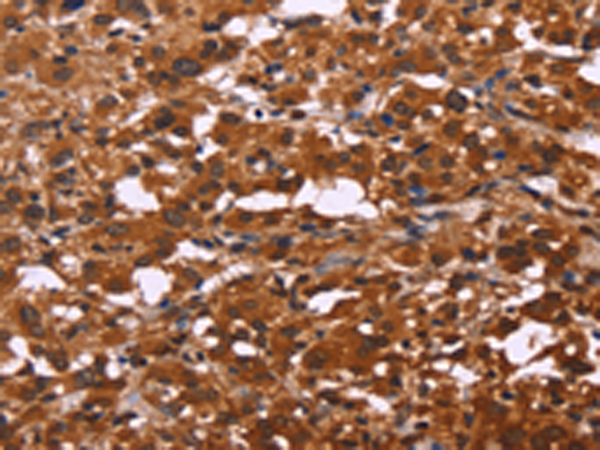 Rabbit Polyclonal Antibody to ART5