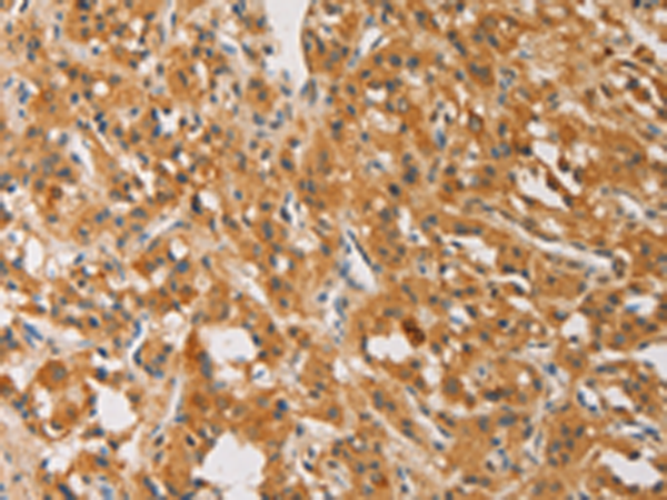 Rabbit Polyclonal Antibody to ATG4D