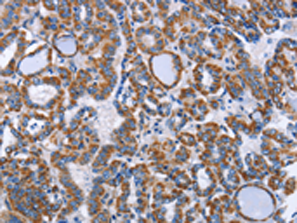 Rabbit Polyclonal Antibody to INTS10