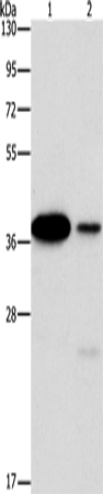 Rabbit Polyclonal Antibody to SAE1