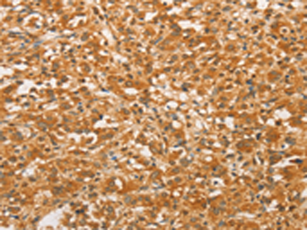 Rabbit Polyclonal Antibody to BCL2L14