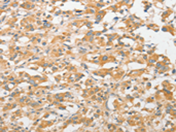 Rabbit Polyclonal Antibody to TLR5