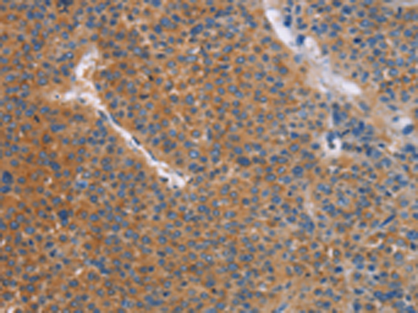 Rabbit Polyclonal Antibody to TLR8
