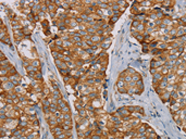 Rabbit Polyclonal Antibody to TLR6