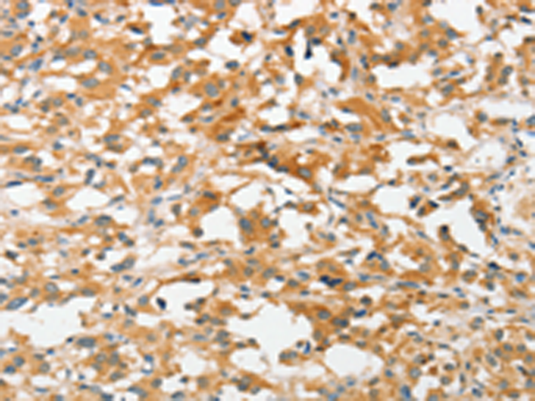 Rabbit Polyclonal Antibody to UCHL5