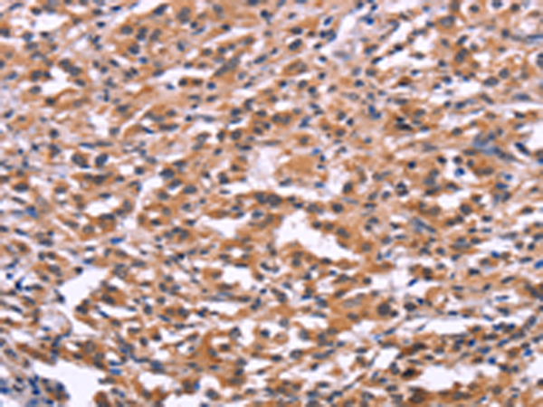 Rabbit Polyclonal Antibody to USP2