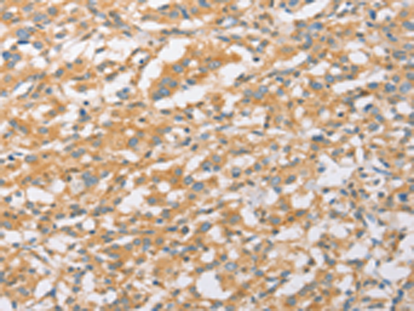Rabbit Polyclonal Antibody to EPS15L1