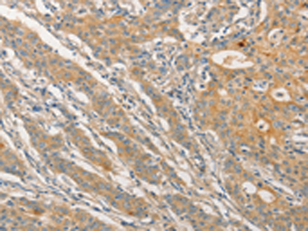 Rabbit Polyclonal Antibody to STAM