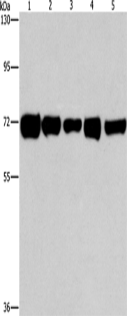 Rabbit Polyclonal Antibody to RPN1