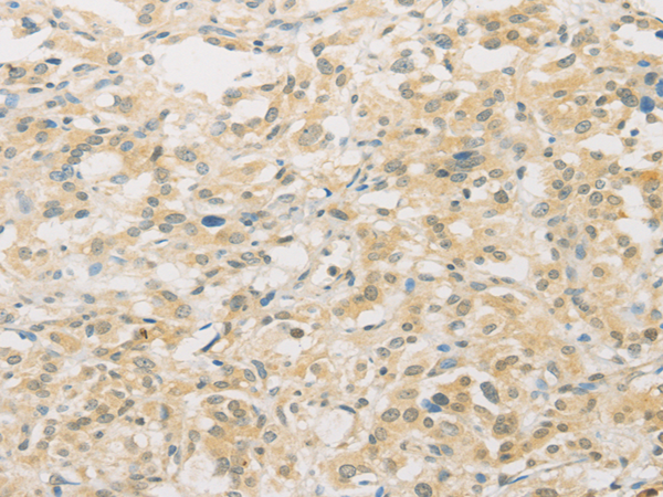 Rabbit Polyclonal Antibody to FNTA
