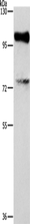 Rabbit Polyclonal Antibody to EZH2