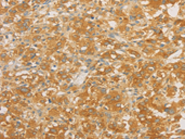 Rabbit Polyclonal Antibody to SPTLC1
