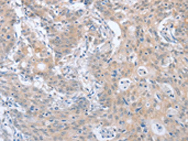 Rabbit Polyclonal Antibody to PAPSS1