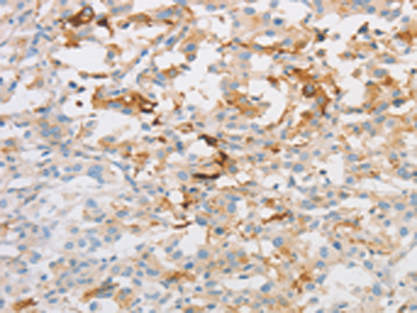 Rabbit Polyclonal Antibody to OLFM1