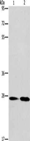 Rabbit Polyclonal Antibody to NAT8