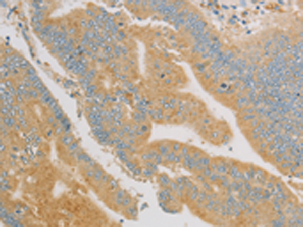 Rabbit Polyclonal Antibody to KLF17