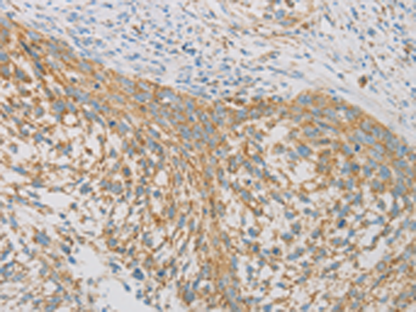 Rabbit Polyclonal Antibody to REN