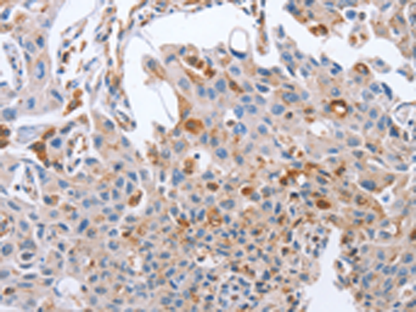 Rabbit Polyclonal Antibody to NRG4