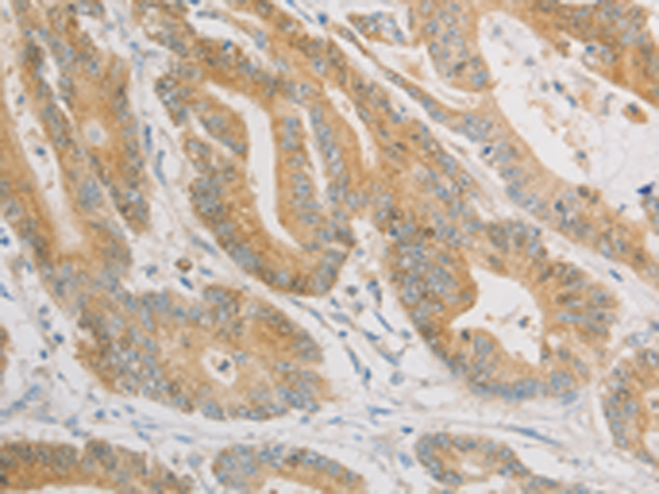 Rabbit Polyclonal Antibody to ZWINT