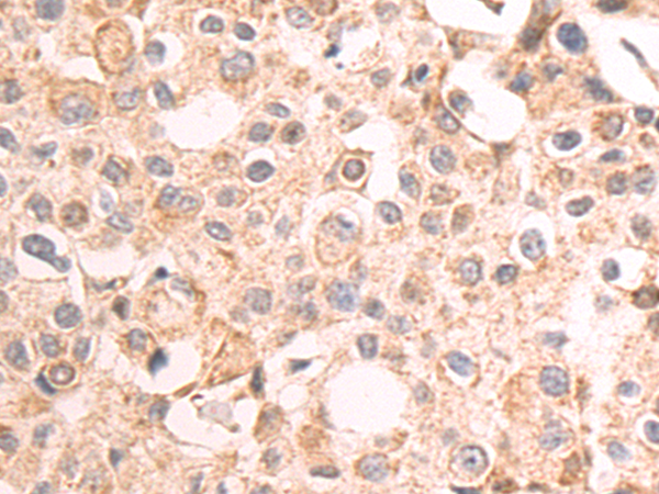 Rabbit Polyclonal Antibody to GRK3