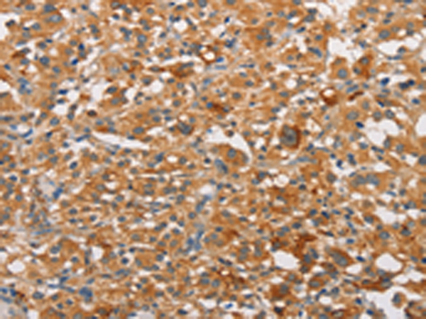 Rabbit Polyclonal Antibody to PRKCE