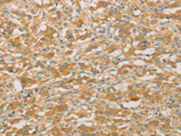 Rabbit Polyclonal Antibody to PRPSAP1