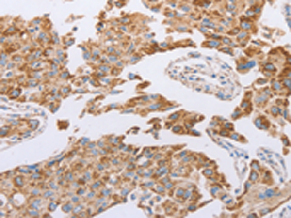Rabbit Polyclonal Antibody to GUCY1A1