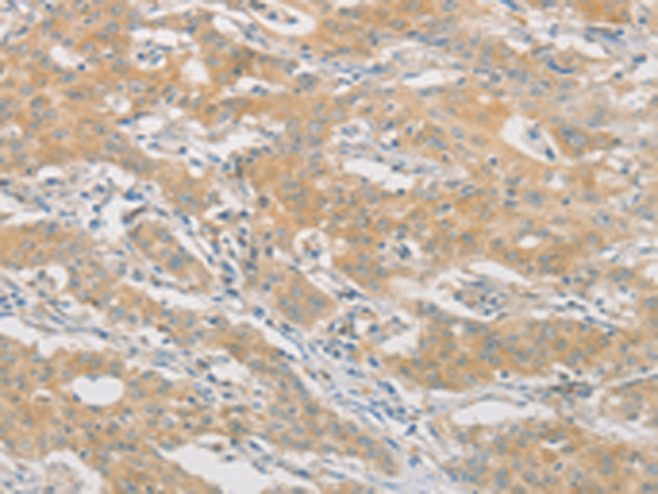 Rabbit Polyclonal Antibody to HIPK4