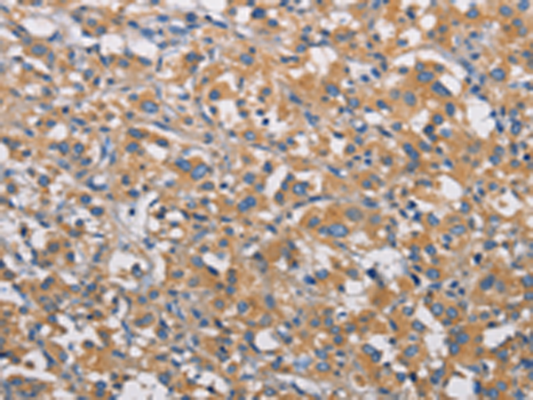 Rabbit Polyclonal Antibody to PIKFYVE