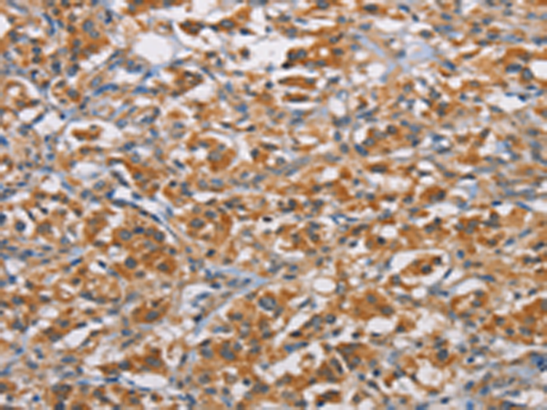 Rabbit Polyclonal Antibody to RICTOR