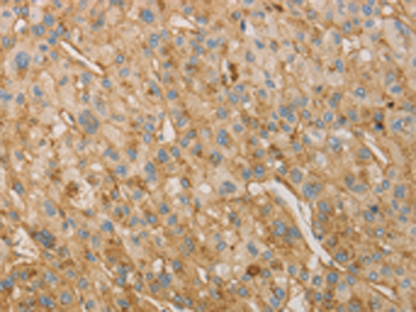 Rabbit Polyclonal Antibody to VTN
