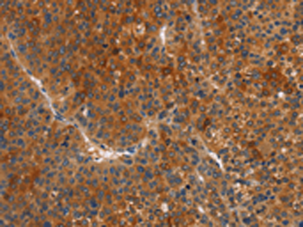 Rabbit Polyclonal Antibody to MAPK15