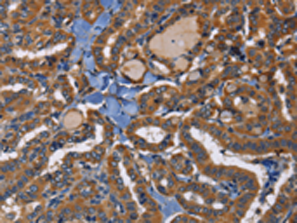 Rabbit Polyclonal Antibody to EPHB6