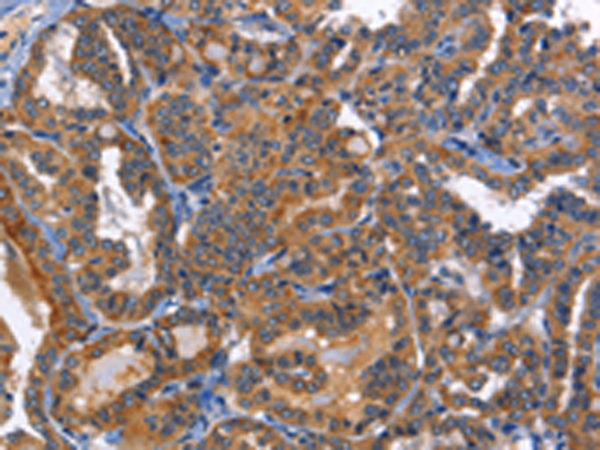 Rabbit Polyclonal Antibody to MUSK