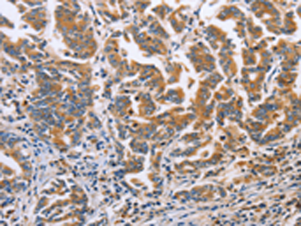 Rabbit Polyclonal Antibody to DOK4