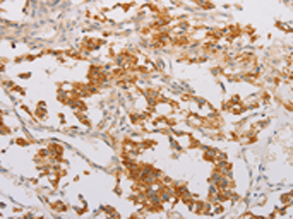 Rabbit Polyclonal Antibody to STK40