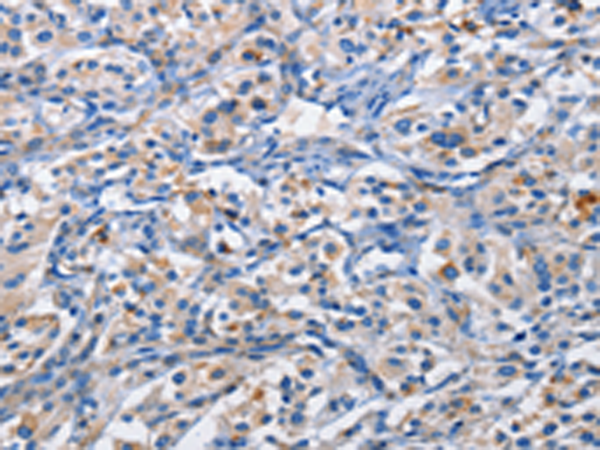 Rabbit Polyclonal Antibody to PIM1