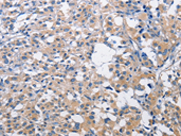 Rabbit Polyclonal Antibody to PIM2