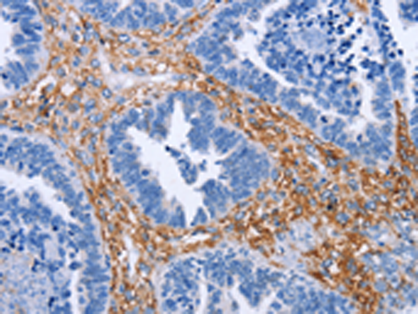Rabbit Polyclonal Antibody to PLK1