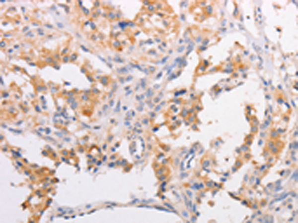 Rabbit Polyclonal Antibody to MYLK3