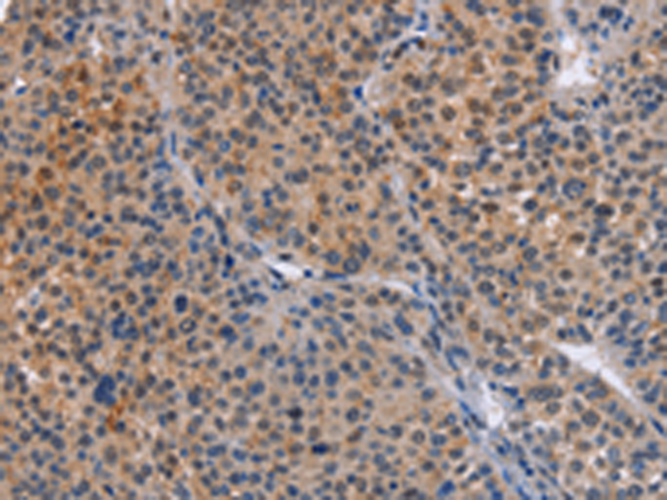 Rabbit Polyclonal Antibody to MAP3K13