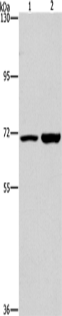 Rabbit Polyclonal Antibody to PIP5K1A