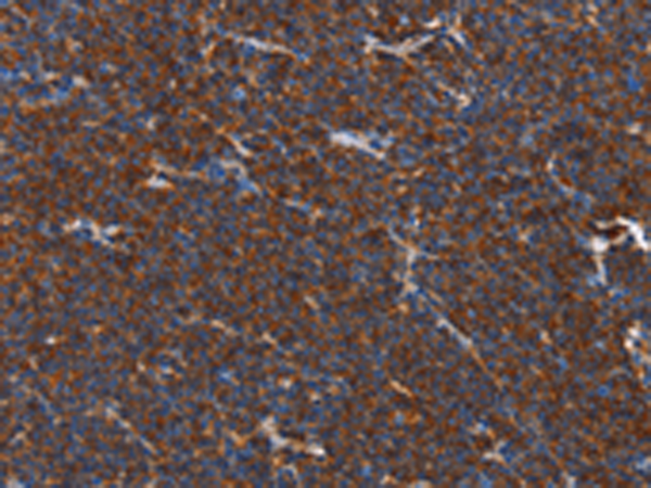 Rabbit Polyclonal Antibody to PLK3