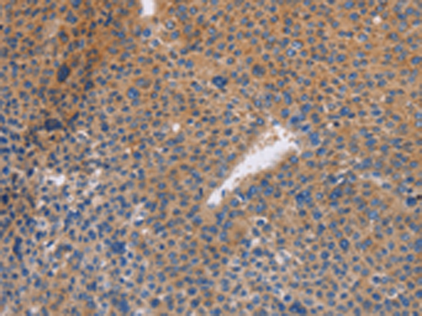 Rabbit Polyclonal Antibody to NEK8