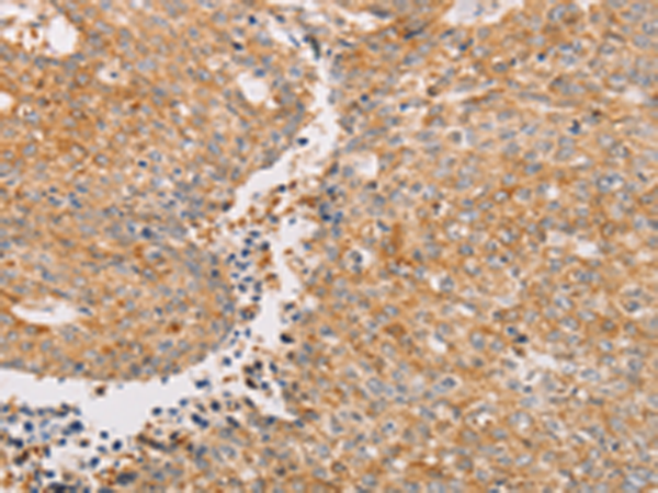 Rabbit Polyclonal Antibody to PACSIN2