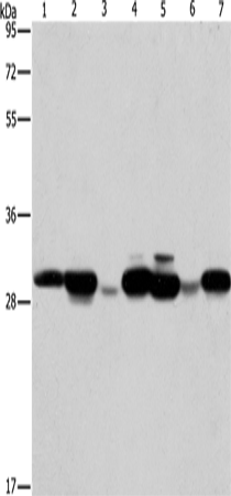 Rabbit Polyclonal Antibody to AK2