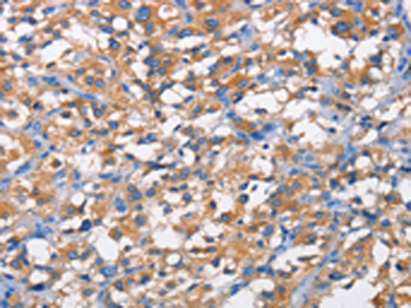 Rabbit Polyclonal Antibody to PFKP